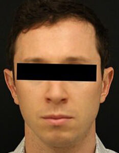 Case # 1 before photo