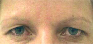 Case # 15 before photo