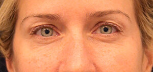 Case # 24 before photo