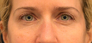 Case # 24 after photo