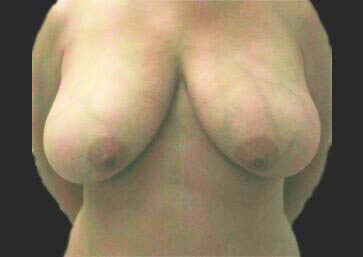 Case # 23 before photo