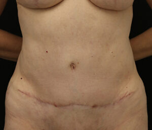 Case # 1 after photo