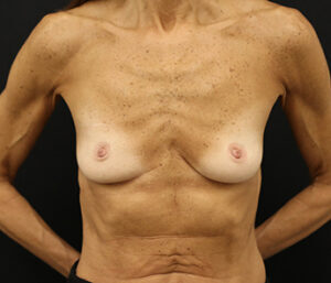 Case # 9 before photo