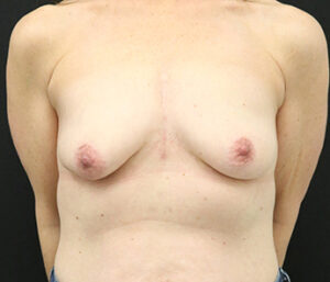 Case # 10 before photo