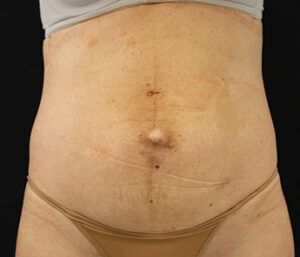 Case # 2 before photo