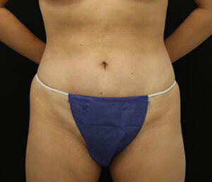 Case # 3 after photo