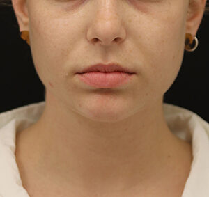 Case # 1 before photo