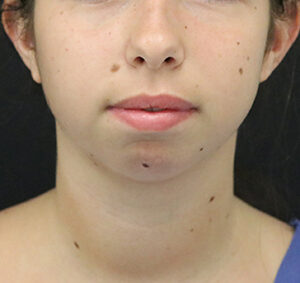 Case # 2 before photo