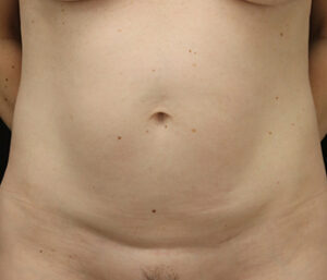 Case # 3 before photo