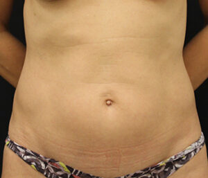 Case # 4 before photo