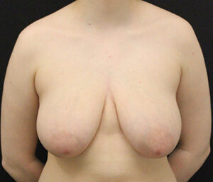 Case # 4 before photo