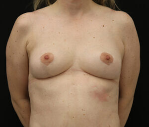 Case # 6 after photo