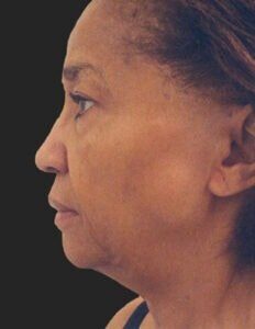 Case # 2 before photo