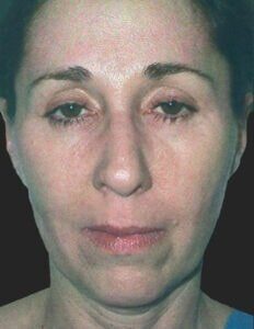 Case # 4 before photo