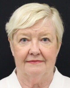 Case # 6 before photo