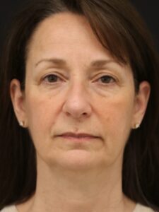 Case # 7 before photo