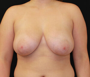 Case # 9 before photo