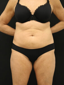 Case # 8 before photo