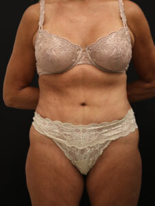 Case # 8 after photo