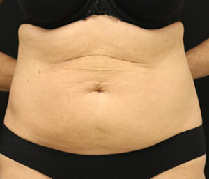 Case # 5 before photo