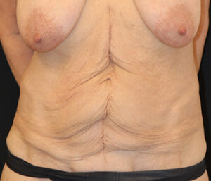 Case # 6 before photo