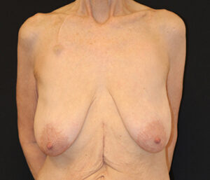 Case # 6 before photo