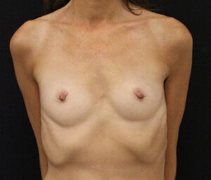 Case # 3 before photo