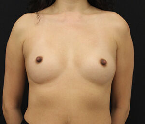 Case # 4 before photo