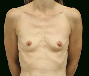 Case # 5 before photo