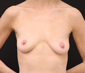 Case # 7 before photo