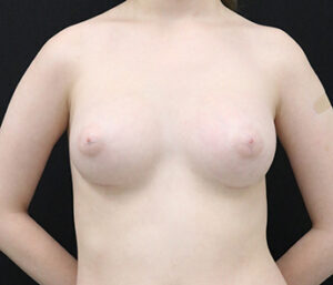 Case # 6 after photo