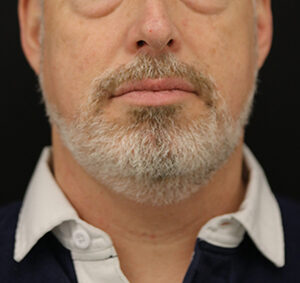 Case # 3 before photo