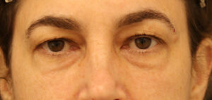 Case # 2 before photo