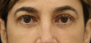 Case # 2 after photo