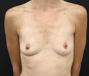 Case # 10 before photo