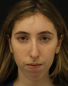 Case # 11 before photo