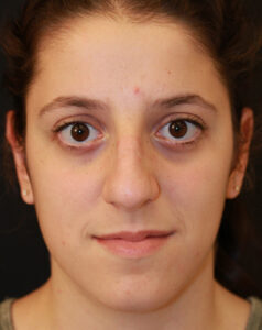 Case # 12 before photo