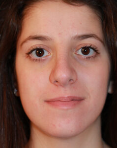 Case # 12 after photo