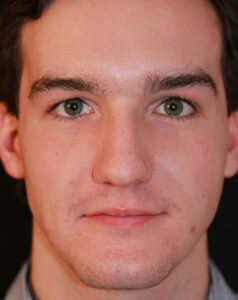 Case # 8 before photo