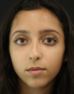 Case # 9 before photo