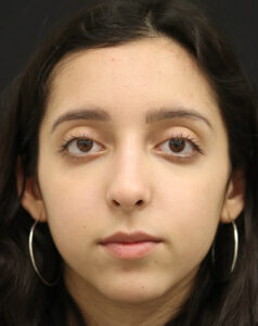 Case # 9 after photo