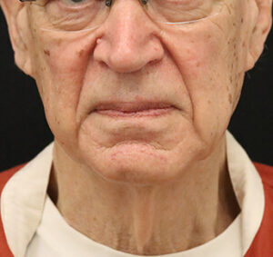 Case # 4 before photo