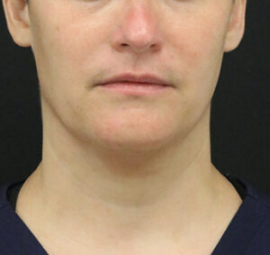 Case # 6 before photo