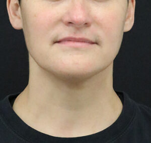 Case # 6 after photo