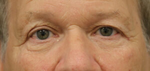 Case # 4 before photo