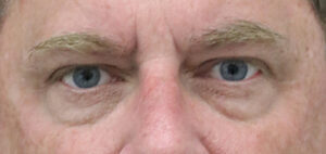 Case # 5 before photo