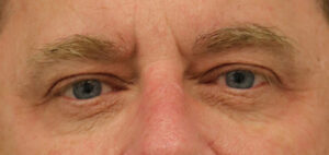 Case # 5 after photo