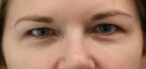 Case # 6 before photo