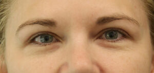 Case # 6 after photo