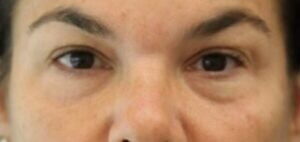 Case # 25 before photo